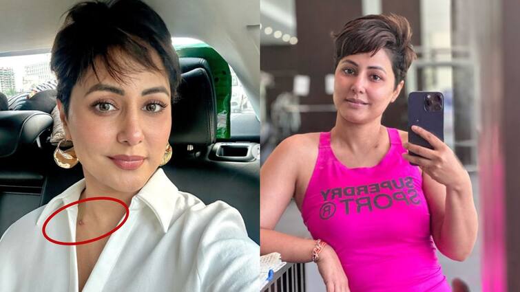 Hina Khan, who is battling cancer