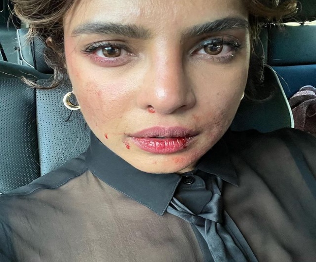 blood on Priyanka Chopra