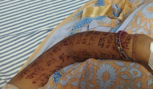  Woman commits suicide,  Chhindwara, police investigating 