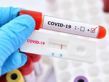 COVID-19 cases , Andhra Pradesh; samples sent,  NIV 